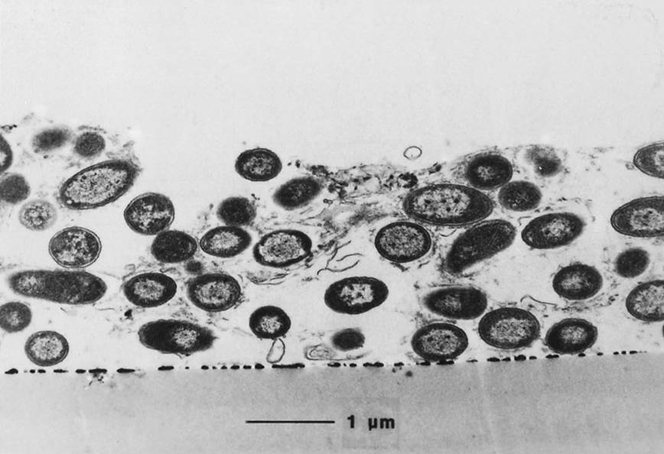 Cross Section of a Biofilm