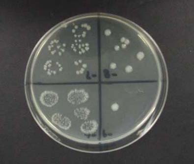 Figure 3. Example of a colonized agar plate
