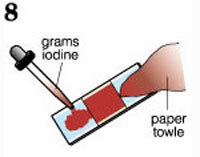 Staining procedure