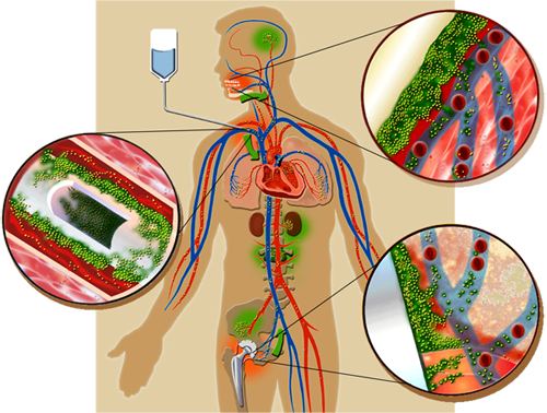 Medical and Dental Biofilms